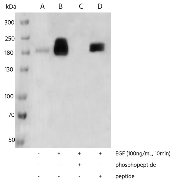 Recombinant Phospho-EGF Receptor (Tyr1068) Monoclonal Antibody - small - 3