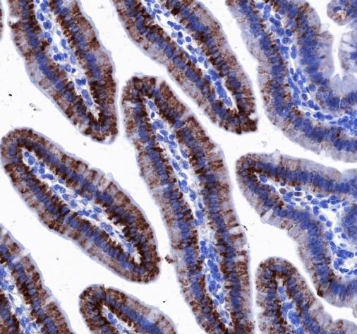 Recombinant MAO-A Monoclonal Antibody - 3