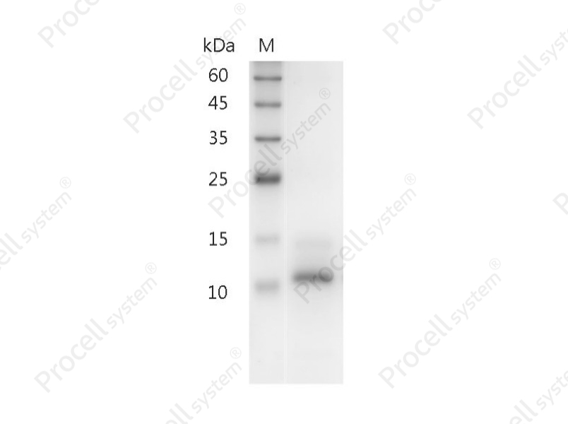 IL-15/IL-T, Human, Recombinant