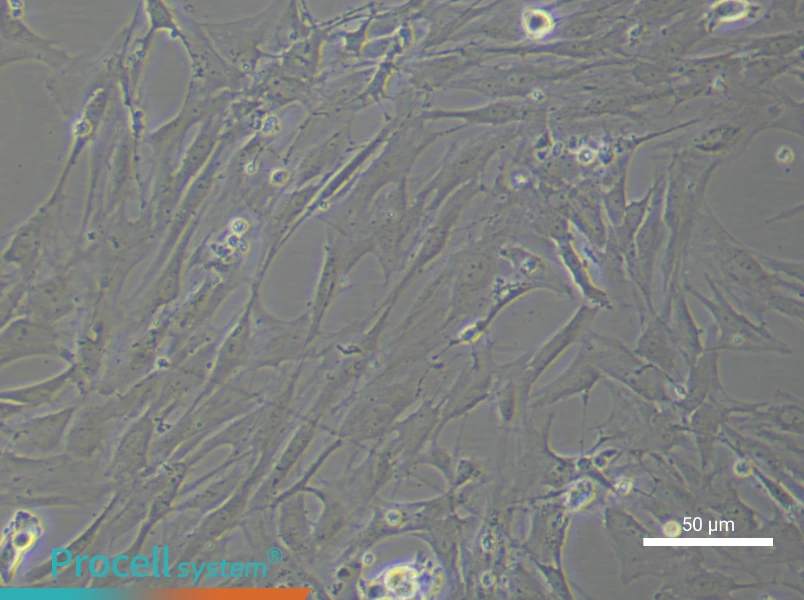 Rat Brain Microvascular Pericyte Complete Medium - 6