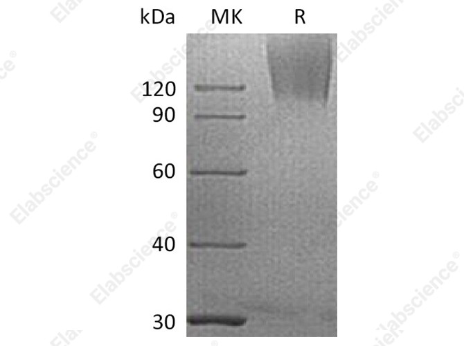 Recombinant Human CEACAM5/CEA Protein (His Tag) - 1