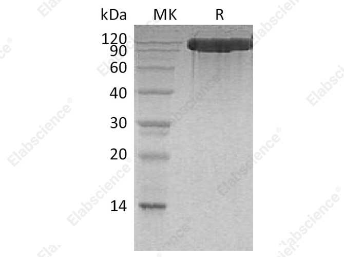 Recombinant Human ACE2 Protein (His Tag) - 1