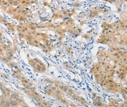 HSP40 Polyclonal Antibody - 3