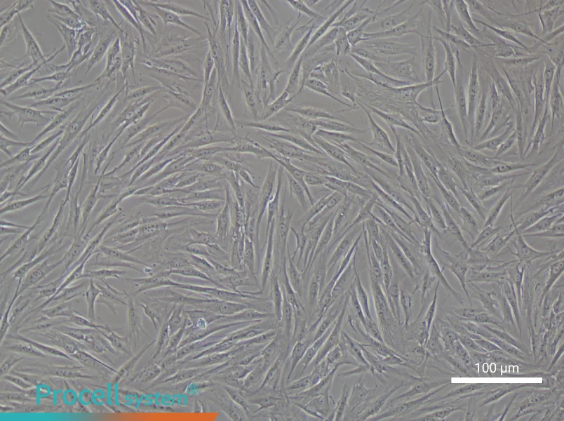 Human Pulmonary Artery Smooth Muscle Cell Complete Medium - 2