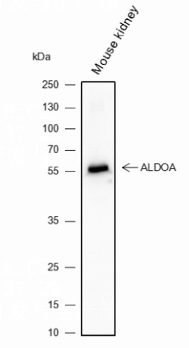 Recombinant Activin A Receptor Type IB/ALK-4 Monoclonal Antibody - 2