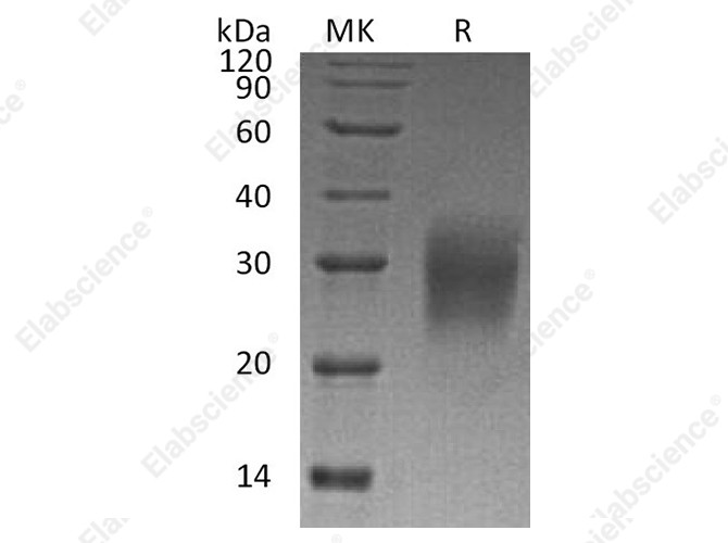 Recombinant Human Interleukin-22/IL-22 Protein - 1