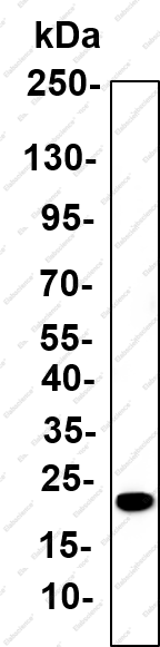 Recombinant Synuclein-α (Phospho Ser129) Monoclonal Antibody - 1
