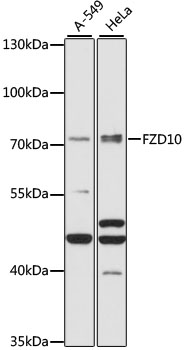 Western blot analysis of extracts of various cell lines using FZD10 Polyclonal Antibody at 1:1000 dilution.