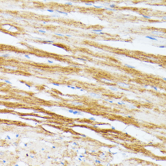 Immunohistochemistry of paraffin-embedded Rat heart using TPM2 Polyclonal Antibody at dilution of 1:100 (40x lens).