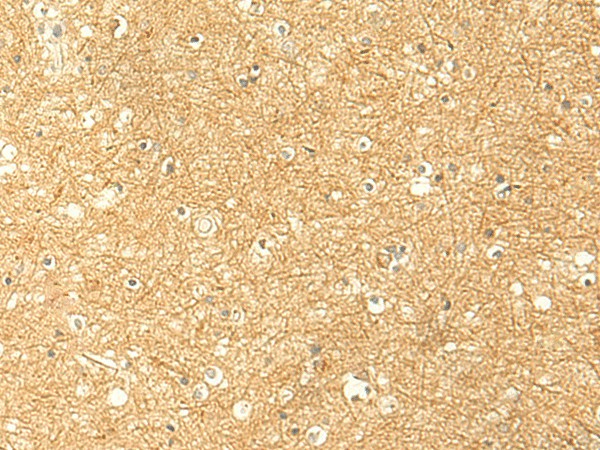 Immunohistochemistry of paraffin-embedded Human brain tissue  using RNF148 Polyclonal Antibody at dilution of 1:50(?200)