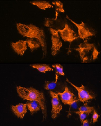 Immunofluorescence analysis of C6 cells using ARF4 Polyclonal Antibody at dilution of 1:100. Blue: DAPI for nuclear staining.