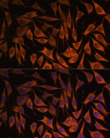 Immunofluorescence analysis of L929 cells using MRPS35 Polyclonal Antibody at dilution of  1:100. Blue: DAPI for nuclear staining.