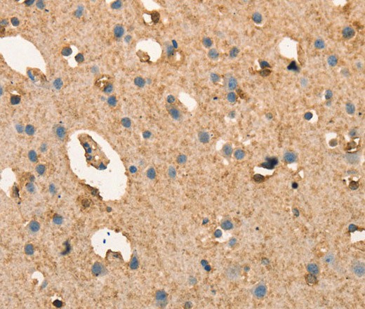 Immunohistochemistry of paraffin-embedded Human brain  tissue using CRELD1 Polyclonal Antibody at dilution 1:40