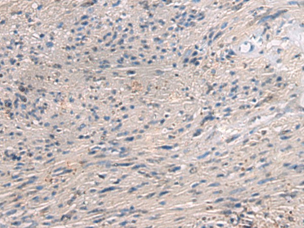 Immunohistochemistry of paraffin-embedded Human brain tissue  using PAIP1 Polyclonal Antibody at dilution of 1:80(?200)