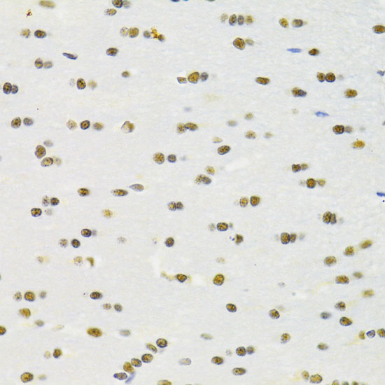 Immunohistochemistry of paraffin-embedded rat brain using RBPJKK Polyclonal Antibody at dilution of 1:100 (40x lens).Perform microwave antigen retrieval with 10 mM PBS buffer pH 7.2 before commencing with IHC staining protocol.