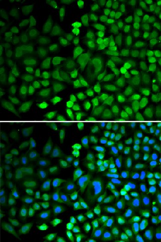 Immunofluorescence analysis of HeLa cells using APEX1/APE1 Polyclonal Antibody Blue: DAPI for nuclear staining.