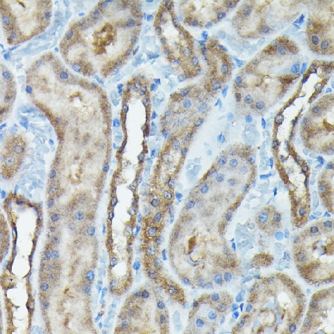 Immunohistochemistry of paraffin-embedded rat kidney using C9orf72 Polyclonal Antibody at dilution of 1:100 (40x lens).Perform high pressure antigen retrieval with 10 mM citrate buffer pH 6.0 before commencing with IHC staining protocol.