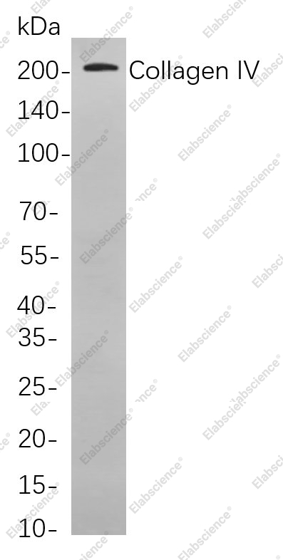 Recombinant Collagen IV Monoclonal Antibody - 1