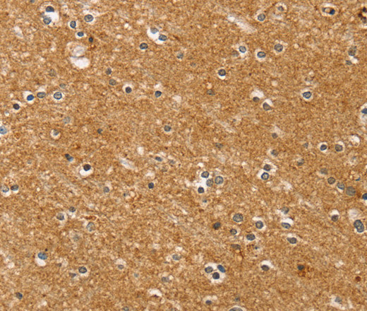 Immunohistochemistry of paraffin-embedded Human brain tissue using SYTL5 Polyclonal Antibody at dilution 1:50