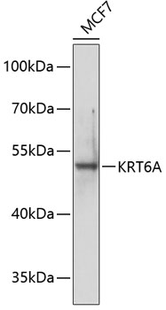 Western blot analysis of extracts of MCF-7 cells using KRT6A Polyclonal Antibody at dilution of 1:1000.