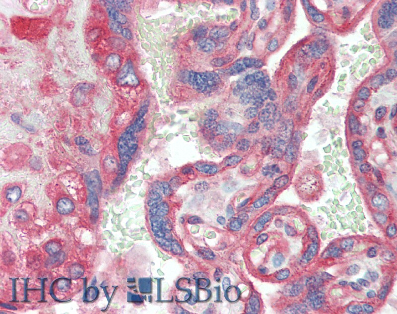 Immunohistochemistry of paraffin-embedded Placenta tissue using CD151 Polyclonal Antibody at dilution of 1:120(Elabscience Product Detected by Lifespan).