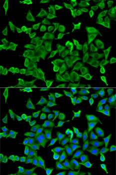 Immunofluorescence analysis of U2OS cells using ACTR2 Polyclonal Antibody