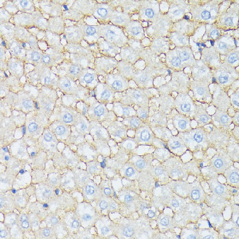 Immunohistochemistry of paraffin-embedded Rat liver using CTNNA2 Polyclonal Antibody at dilution of  1:100 (40x lens).