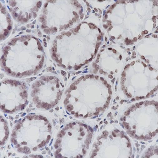 Recombinant ERCC1 Monoclonal Antibody-searchlist-1