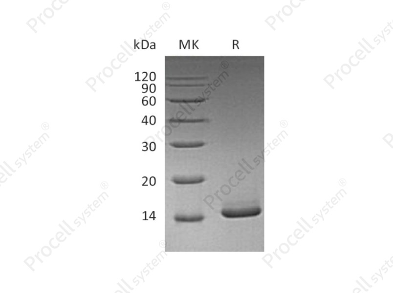 GM-CSF/CSF2/MGI-I/MGI-IGM, Mouse, Recombinant