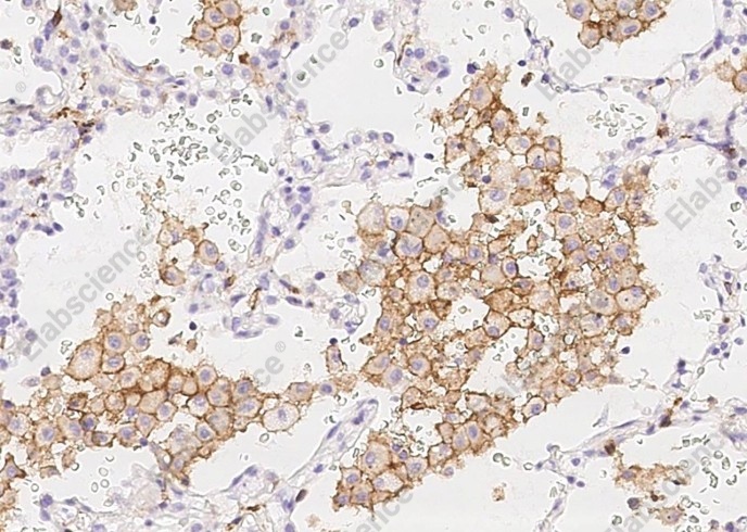 CD16b/FCGR3B Monoclonal Antibody - 3