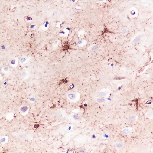 Recombinant S100A1 Monoclonal Antibody - 2