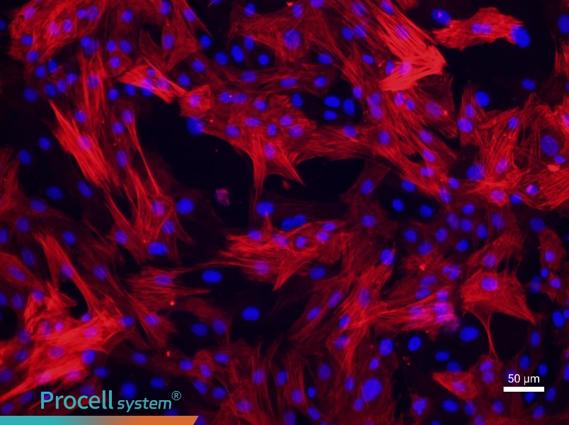 Rat Pulmonary Great Artery Smooth Muscle Cell Complete Medium - 1