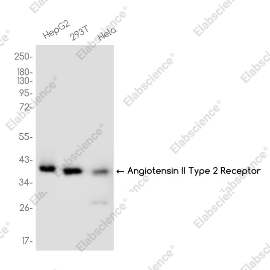 Recombinant Angiotensin II Type 2 Receptor Monoclonal Antibody - 1