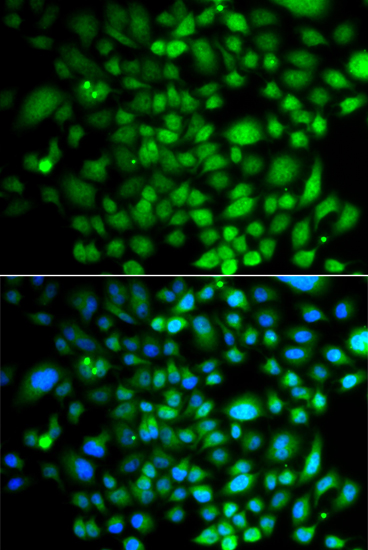 Immunofluorescence analysis of A549 cells using PTK6 Polyclonal Antibody Blue: DAPI for nuclear staining.