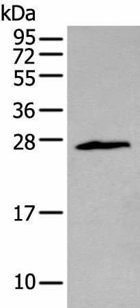 Western blot analysis of Jurkat cell  using ZNF22 Polyclonal Antibody at dilution of 1:400