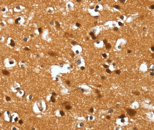 Immunohistochemistry of paraffin-embedded Human brain  tissue using DEFA4 Polyclonal Antibody at dilution 1:40