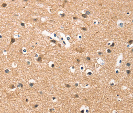 Immunohistochemistry of paraffin-embedded Human brain tissue using HDAC8 Polyclonal Antibody at dilution 1:50