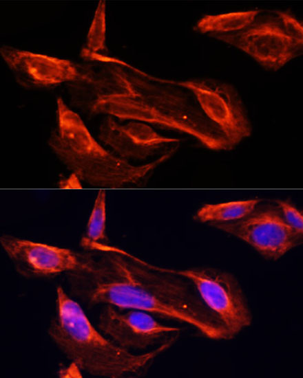 Immunofluorescence analysis of U2OS cells using MMP2 Polyclonal Antibody at dilution of  1:100. Blue: DAPI for nuclear staining.