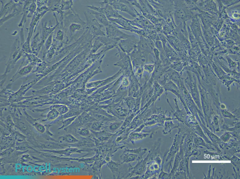 Mouse Pulmonary Artery Smooth Muscle Cell Complete Medium - small - 6