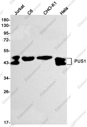 Recombinant PUS1 Monoclonal Antibody - 1
