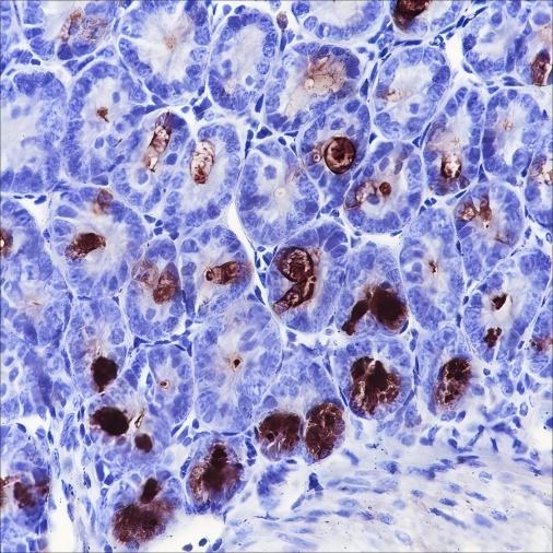Recombinant MPTX Monoclonal Antibody - 2