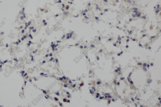 NOTCH1 Polyclonal Antibody - 2