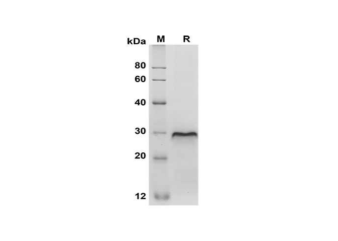 Recombinant Human IL22 Protein(Avi,His Tag)-产品推荐-1