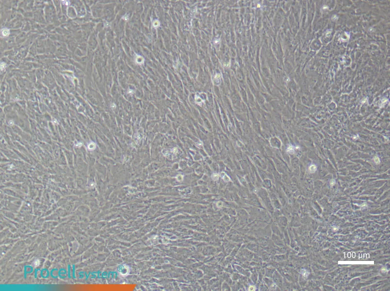 Human Mammary Cancer Fibroblast (Primary cell immortalization) Complete MediumHuman Mammary Cancer Fibroblast (Primary cell immortalization) Complete Medium - 1