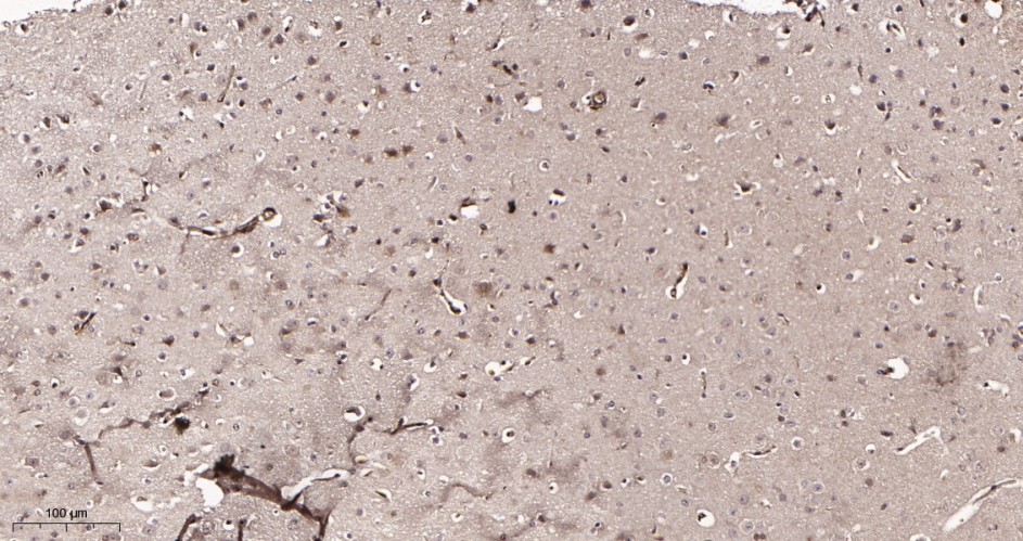 Recombinant Hsp70 Monoclonal Antibody - small - 3