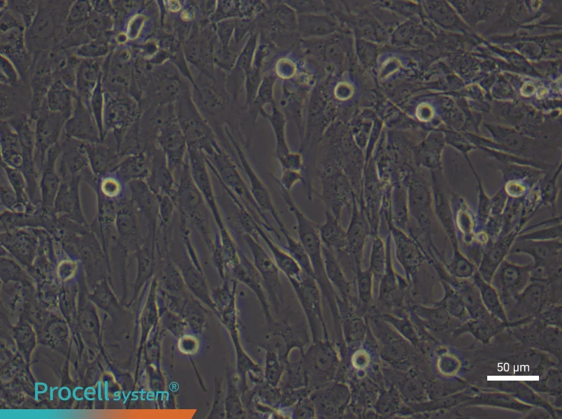 Human Lung Fibroblast (Primary cell immortalization) Complete Medium - 4