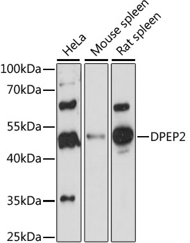 Western blot analysis of extracts of various cell lines using DPEP2 Polyclonal Antibody at 1:1000 dilution.