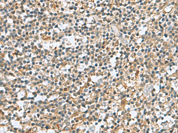 Immunohistochemistry of paraffin-embedded Human tonsil tissue  using DNPH1 Polyclonal Antibody at dilution of 1:60(?200)