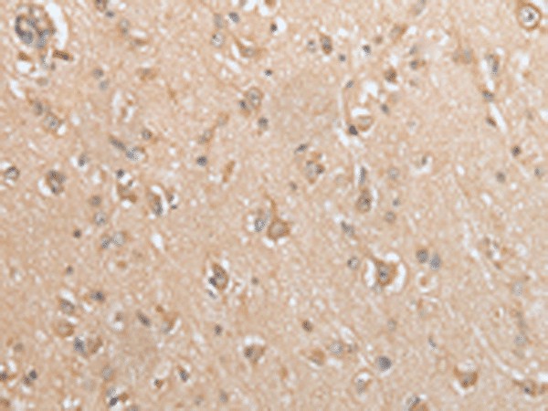 Immunohistochemistry of paraffin-embedded Human brain tissue  using GCLC Polyclonal Antibody at dilution of 1:35(?200)