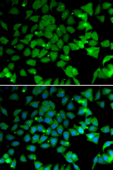 Immunofluorescence analysis of U2OS cells using NAA10 Polyclonal Antibody